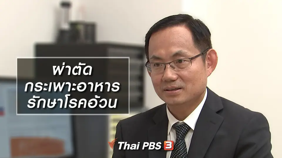 ผ่าตัดกระเพาะอาหาร รักษาโรคอ้วน