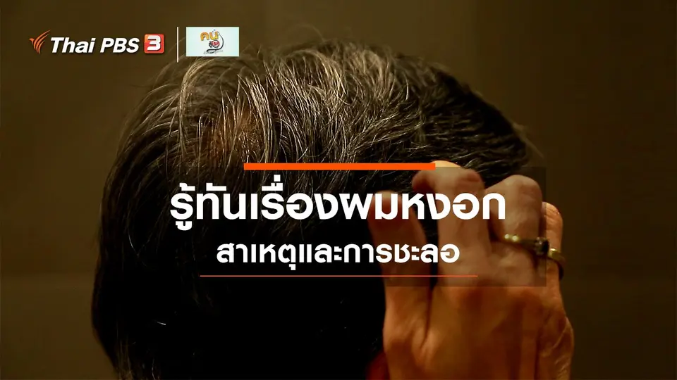 รู้สู้โรค : รู้ทันเรื่องผมหงอก