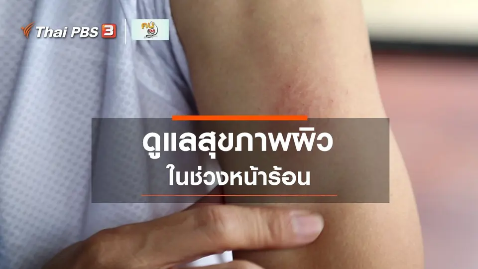 ​ปรับก่อนป่วย : ดูแลสุขภาพผิวในช่วงหน้าร้อน