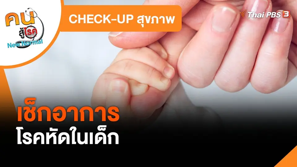 CHECK-UP สุขภาพ : เช็กอาการโรคหัดในเด็ก