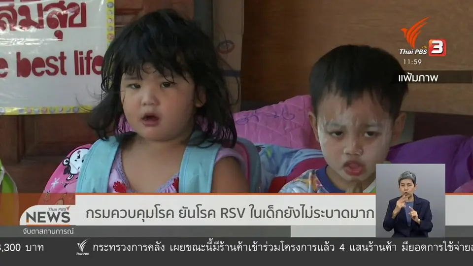 กรมควบคุมโรค ยันโรค RSV ในเด็กยังไม่ระบาดมาก