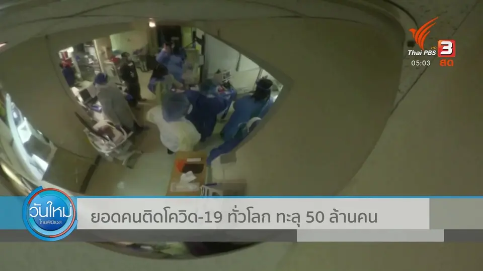 ยอดคนติดโควิด-19 ทั่วโลก ทะลุ 50 ล้านคน