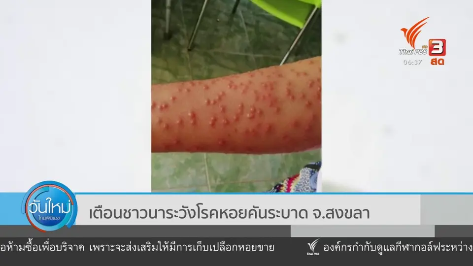 เตือนชาวนาระวังโรคหอยคันระบาด จ.สงขลา
