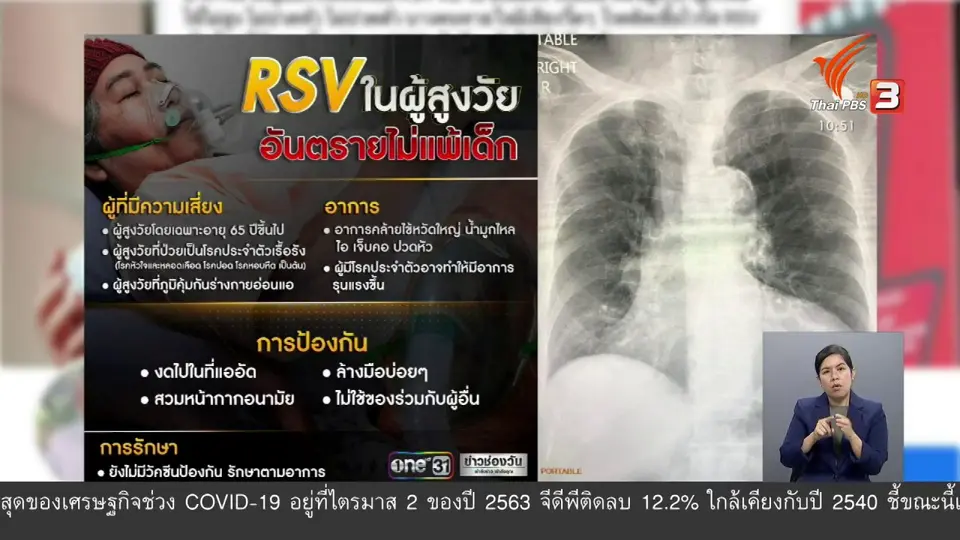 แพทย์เตือนผู้สูงอายุติดเชื้ออาร์เอสวีอาจมีอาการรุนแรง