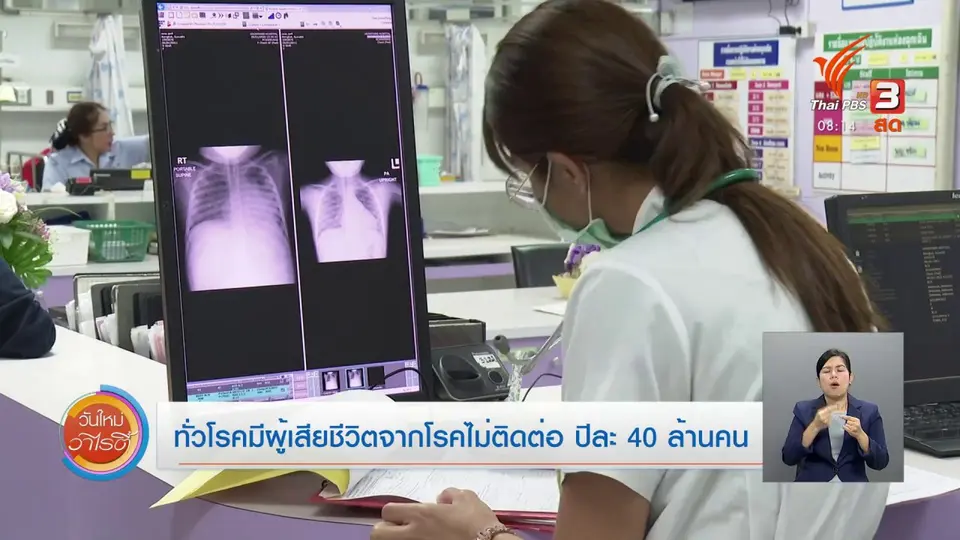 ​จับตาข่าวเด่น​ : ทั่วโลกมีผู้เสียชีวิตจากโรคไม่ติดต่อ ปีละ 40 ล้านคน