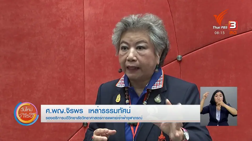 ​จับตาข่าวเด่น​ : ราชวิทยาลัยจุฬาภรณ์ เดินหน้าคัดกรองมะเร็งลำไส้ใหญ่