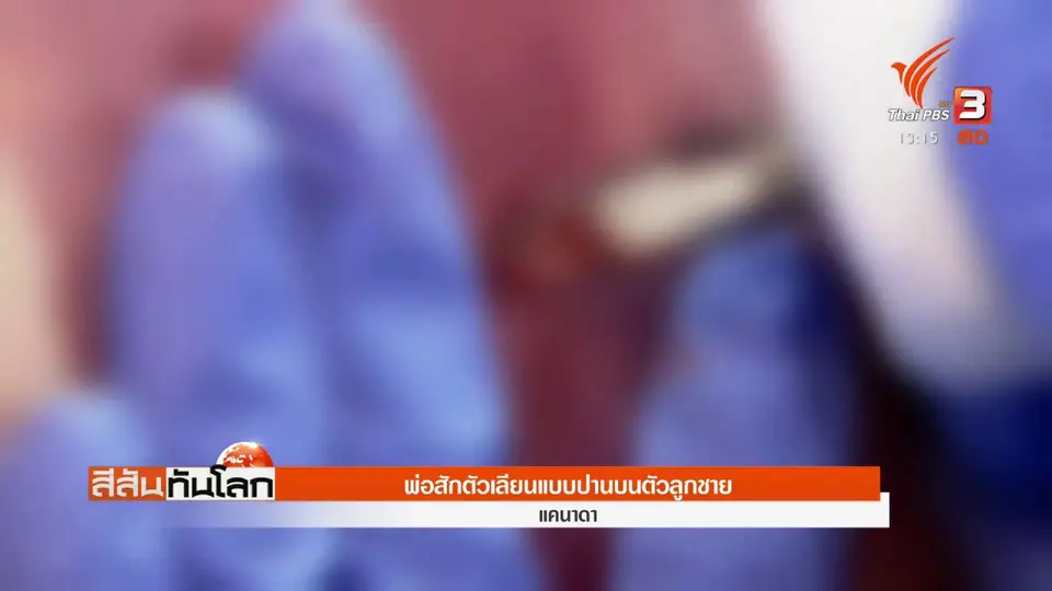 ​พ่อสักตัวเลียนแบบปานบนตัวลูกชาย