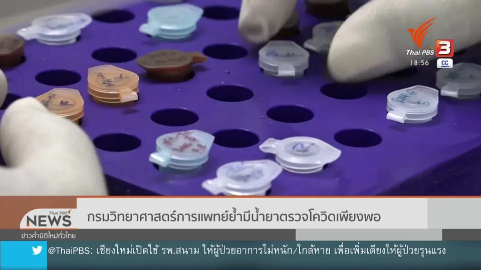 ​กรมวิทยาศาสตร์การแพทย์ย้ำมีน้ำยาตรวจโควิดเพียงพอ