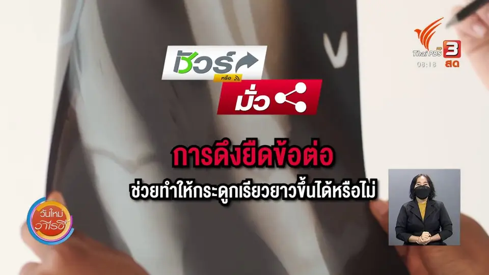 ชัวร์หรือมั่ว : ท่าบริหารยืดนิ้วยาว ?