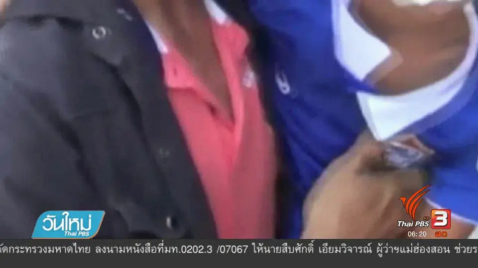 พ่อพาลูกสาววัย 8 ขวบ ร้องสื่อหลังถูกสุนัขกัดเย็บ 30 เข็ม