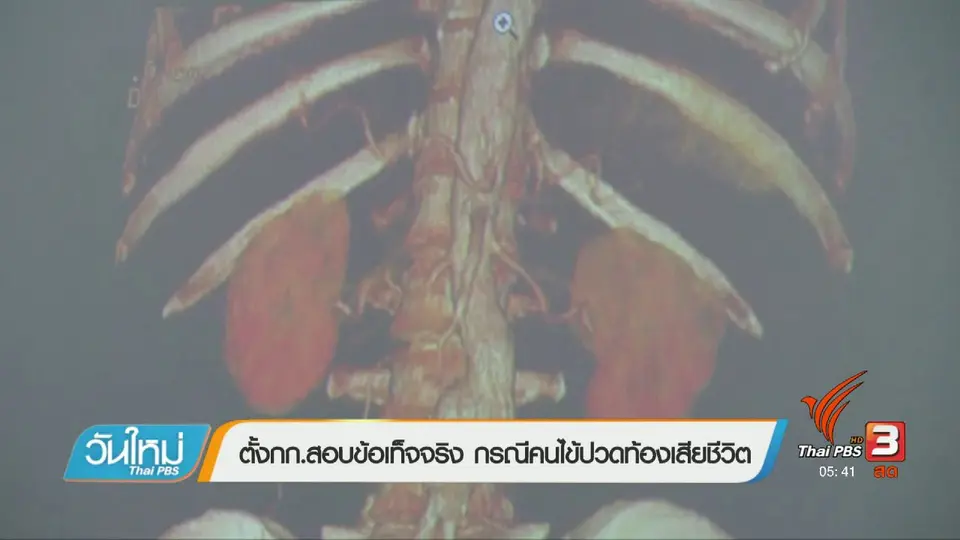 ตั้ง กก.สอบข้อเท็จจริง กรณีคนไข้ปวดท้องเสียชีวิต
