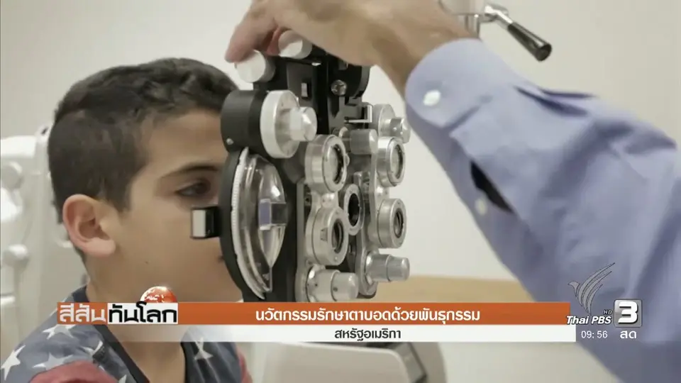 นวัตกรรมรักษาตาบอดด้วยพันธุกรรม