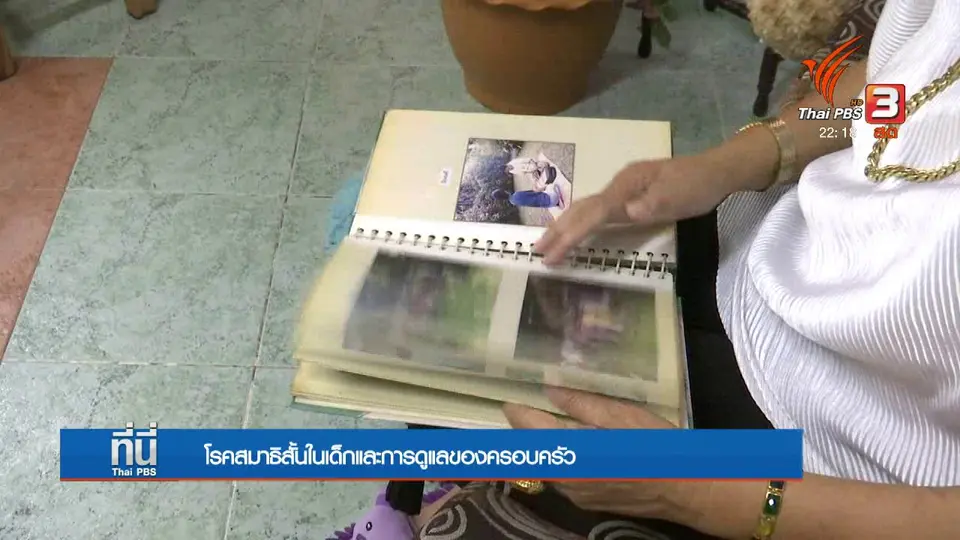 โรคสมาธิสั้นในเด็ก