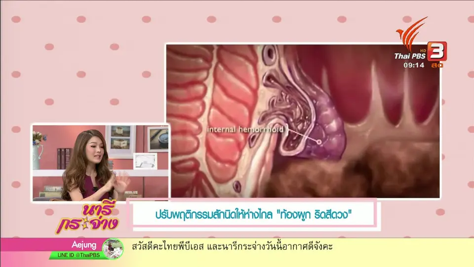 นารีกระจ่าง : ปรับพฤติกรรมให้ห่างไกล “ท้องผูก - ริดสีดวง”