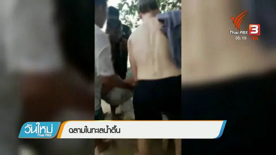 คาดฉลามหัวบาตรกัดนักท่องเที่ยว