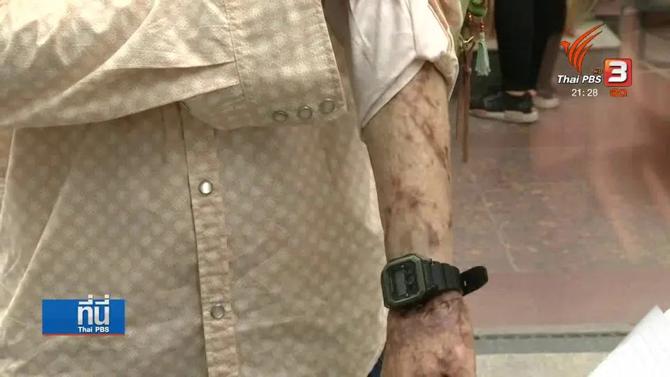 3 ปี เหตุระเบิดย่านราชประสงค์