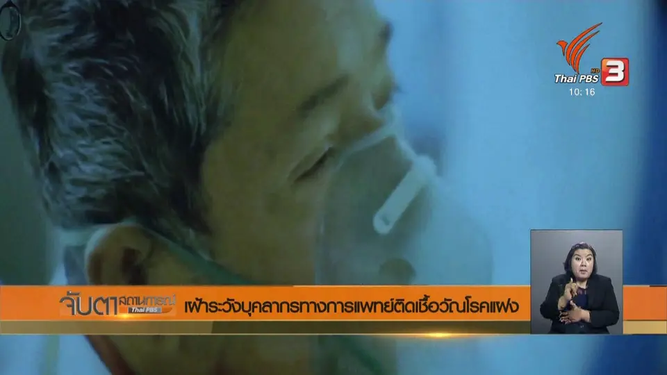 เฝ้าระวังบุคลากรทางการแพทย์ติดเชื้อวัณโรคแฝง