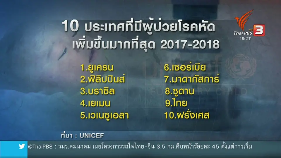 ​วิเคราะห์สถานการณ์ต่างประเทศ : ปัญหาโรคหัดระบาดลุกลามหลายชาติทั่วโลก