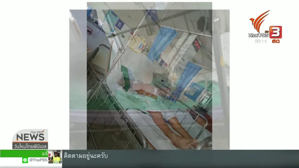 จับตาข่าวเด่น : รพ.วินิจฉัยโรคผิดพลาด รักษาผิดจนคนไข้ไส้ติ่งแตก​