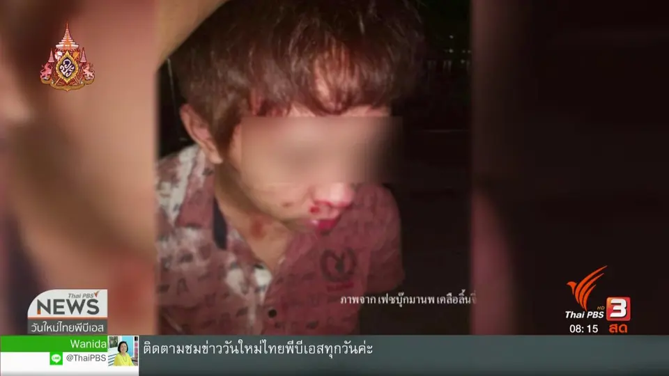 จับตาข่าวเด่น : คนขับแกร็บคาร์ถูกแทง ตำรวจแจงไม่ใช่เหตุซึ่งหน้า จับไม่ได้