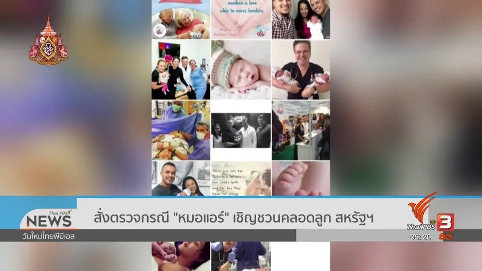 สั่งตรวจกรณี หมอแอร์ เชิญชวนคลอดลูก สหรัฐฯ