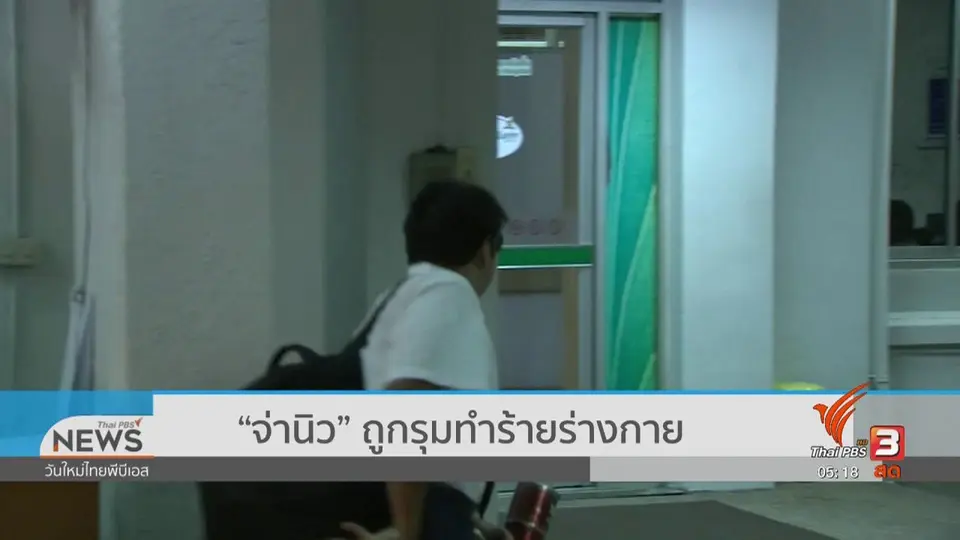 “จ่านิว” ถูกรุมทำร้ายร่างกาย