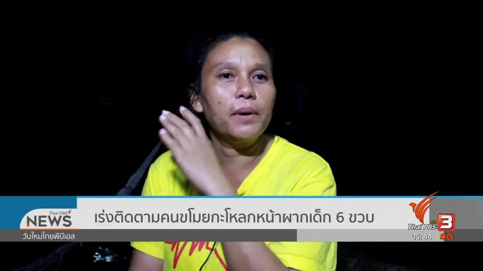 ​เร่งติดตามคนขโมยกะโหลกหน้าผากเด็ก 6 ขวบ