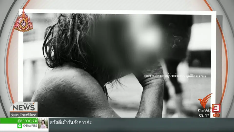 ประเด็นทางสังคม : ผู้ป่วยจิตเวชไร้บ้านกับความเท่าเทียมที่ต้องฟื้นฟู