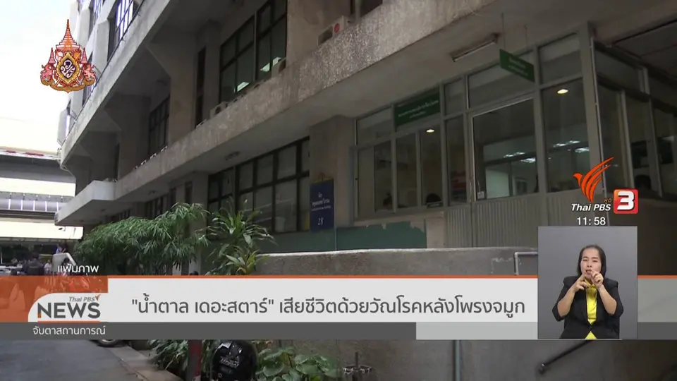 "น้ำตาล เดอะสตาร์" เสียชีวิตด้วยวัณโรคหลังโพรงจมูก