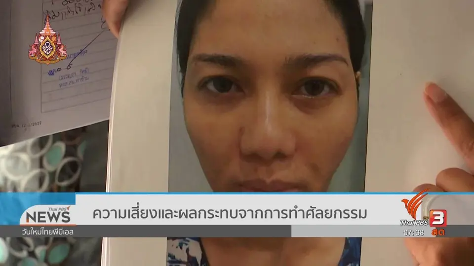 รู้เท่าทันภัย : ความเสี่ยงและผลกระทบจากการทำศัลยกรรม