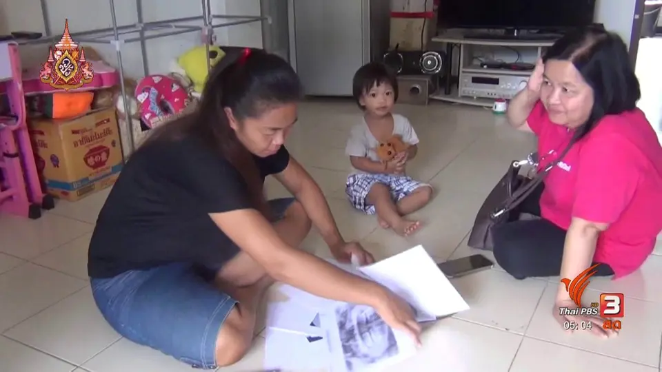 ร้องเรียนลืมหัวกรอฟันไว้ในช่องปากนานเกือบ 5 ปี