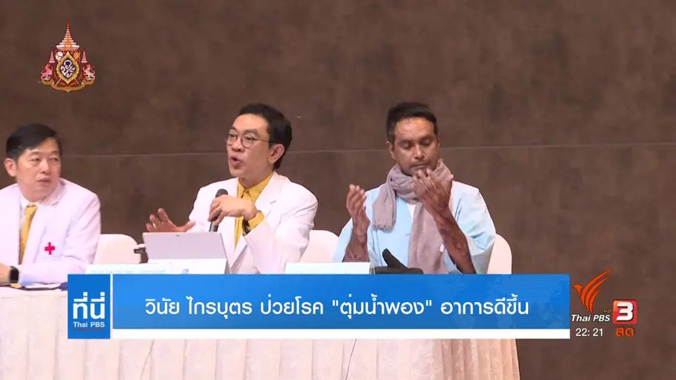 "วินัย ไกรบุตร" ป่วยโรคตุ่มน้ำพอง อาการดีขึ้น