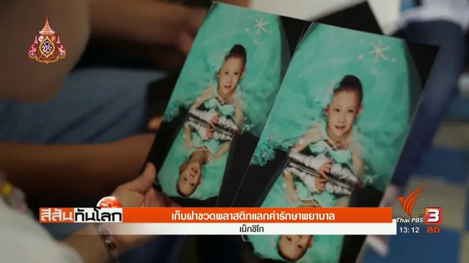 เก็บฝาขวดพลาสติกแลกค่ารักษาพยาบาล