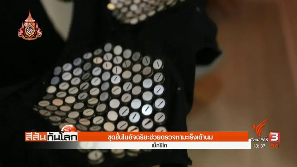 ชุดชั้นในอัจฉริยะช่วยตรวจหามะเร็งเต้านม
