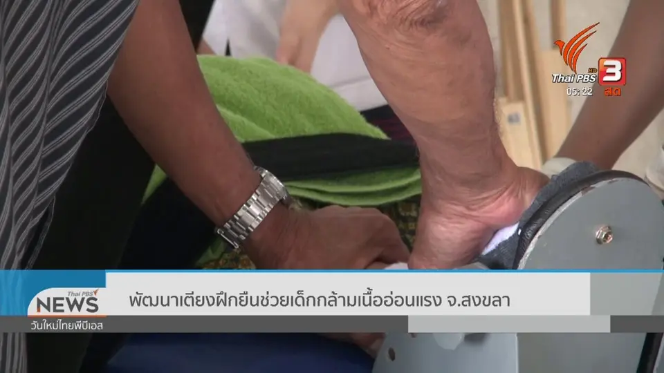 พัฒนาเตียงฝึกยืนช่วยเด็กกล้ามเนื้ออ่อนแรง จ.สงขลา