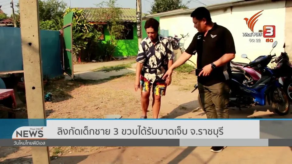 ​ลิงกัดเด็กชาย 3 ขวบได้รับบาดเจ็บ จ.ราชบุรี