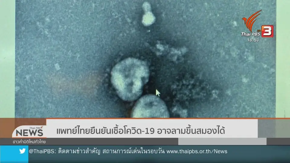 ​แพทย์ไทยยืนยันเชื้อโควิด-19 อาจลามขึ้นสมองได้