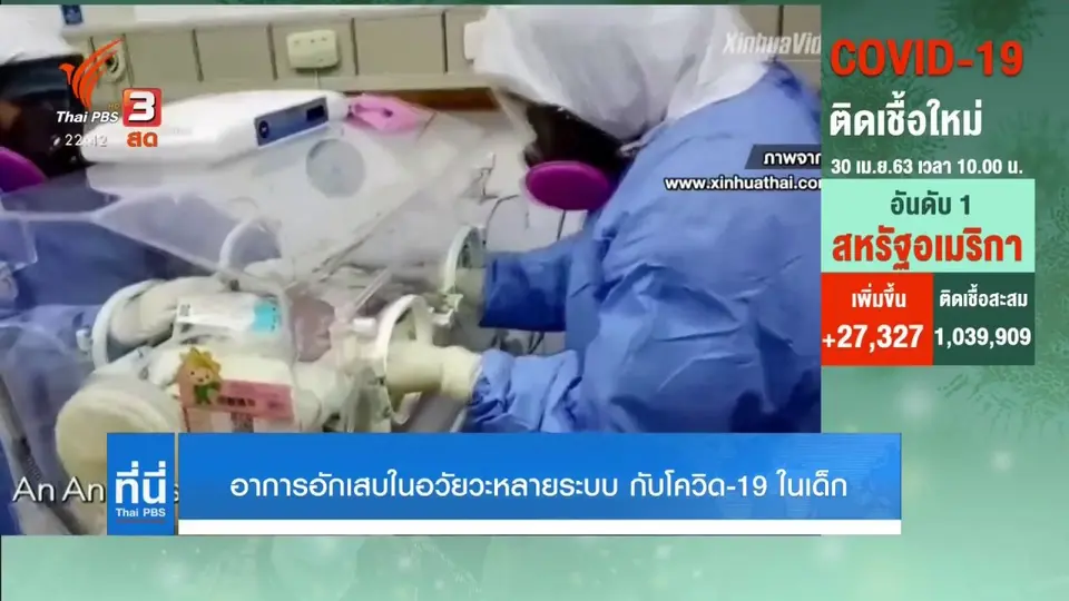 อาการอักเสบในอวัยวะหลายระบบ กับโควิด-19 ในเด็ก