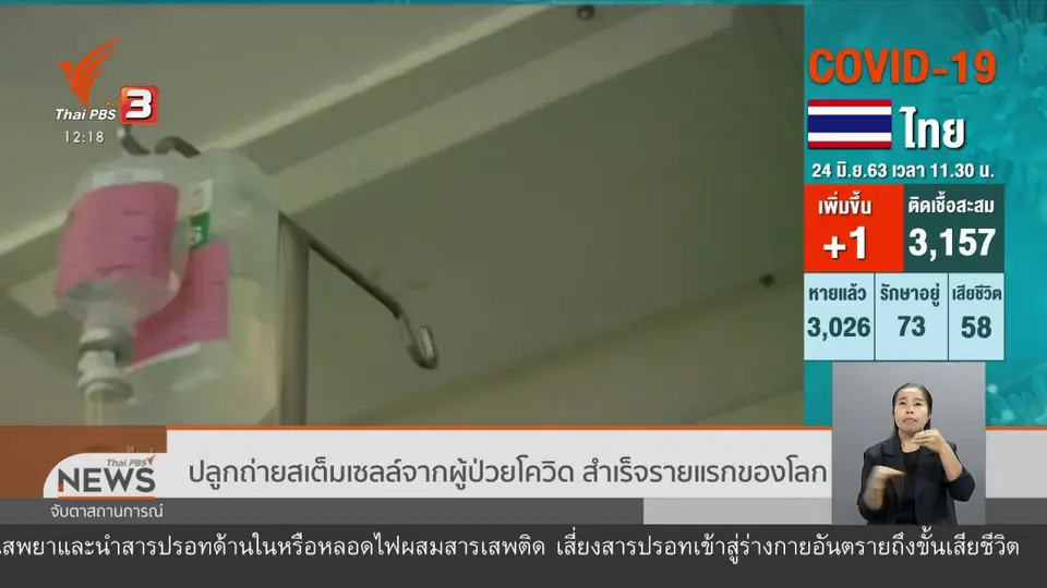 ปลูกถ่ายสเต็มเซลล์จากผู้ป่วยโควิด สำเร็จรายแรกของโลก