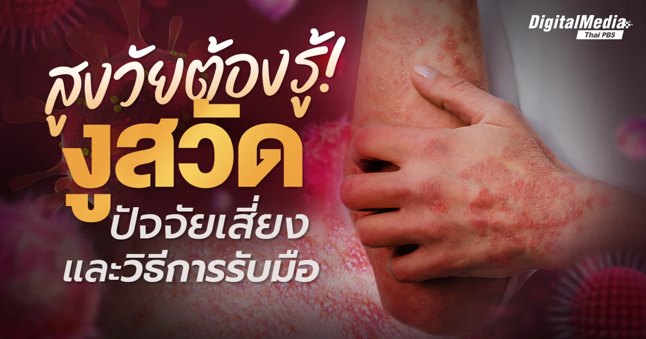 สูงวัยต้องรู้! งูสวัดคืออะไร? ปัจจัยเสี่ยงและวิธีการรับมือ