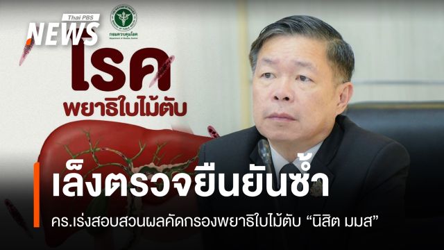 คร.เร่งสอบสวนผลคัดกรองพยาธิใบไม้ตับ "นิสิต มมส" เล็งตรวจยืนยันซ้ำ