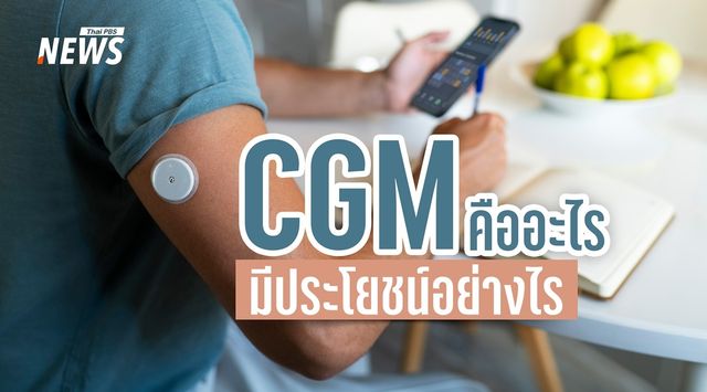 CGM คืออะไร? รู้จักเครื่องวัดระดับน้ำตาลต่อเนื่อง ใครควรใช้ และมีประโยชน์อย่างไร