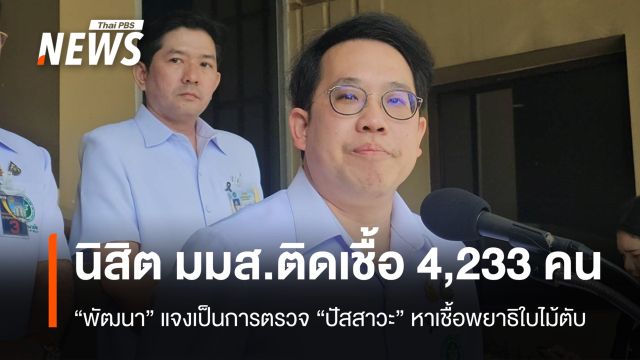 "พัฒนา" แจง นิสิต มมส ติดเชื้อพยาธิใบไม้ตับ 4,233 คน เป็นการตรวจจากปัสสาวะ