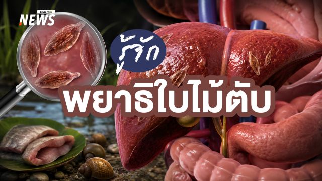  วงจรชีวิต "พยาธิใบไม้ตับ" ภัยเงียบจากเมนูปลาน้ำจืดดิบ วิธีป้องกัน