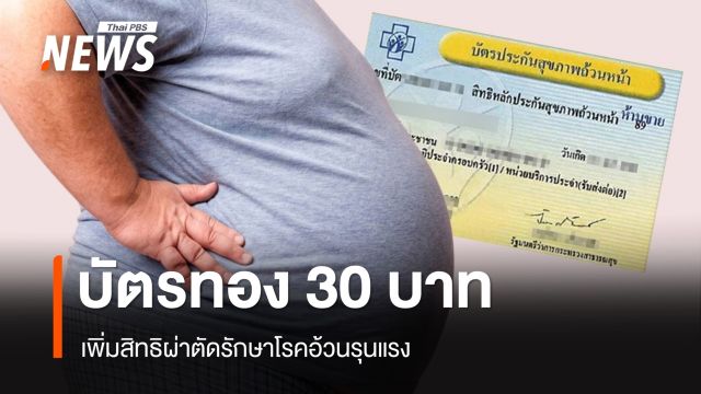 บัตรทอง 30 บาท เพิ่มสิทธิผ่าตัดโรคอ้วน ช่วยผู้ป่วยเข้าเกณฑ์ข้อบ่งชี้แพทย์ 