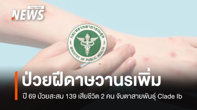 ฝีดาษวานร ปี 69 ไทยป่วยสะสม 139 คน เสียชีวิต 2 คน "Clade Ib" แซงสายพันธุ์เดิม