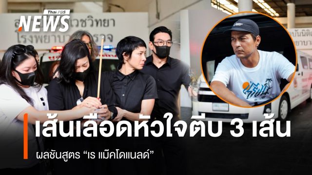 ผลชันสูตร "เร แม๊คโดแนลด์" เส้นเลือดหัวใจตีบ 3 เส้น
