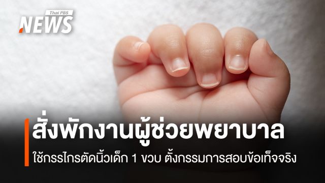 สั่งพักงานผู้ช่วยพยาบาล ใช้กรรไกรตัดนิ้วเด็ก 1 ขวบ สสจ.ยโสธรตั้งกรรมการสอบข้อเท็จจริง