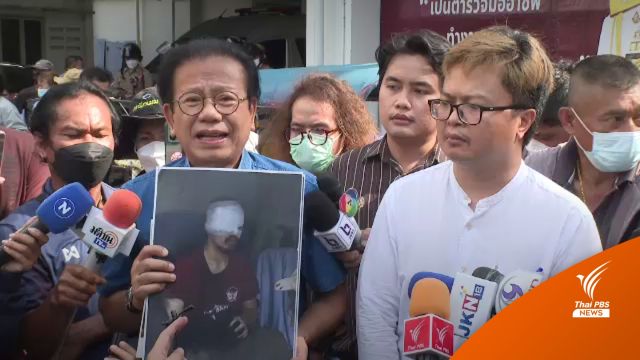 ผู้บาดเจ็บจากชุมนุม ราษฎรหยุด APEC 2022 แจ้งความเอาผิดตำรวจ