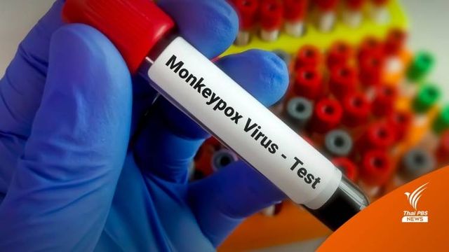 ฝีดาษลิงทั่วโลกติด 6,178 คนลาม 56 ชาติหนักสุดยุโรป